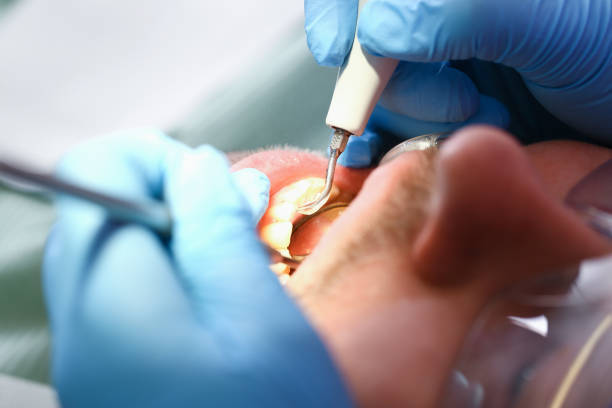 Best Walk-In Emergency Dental Services in Central High, OK