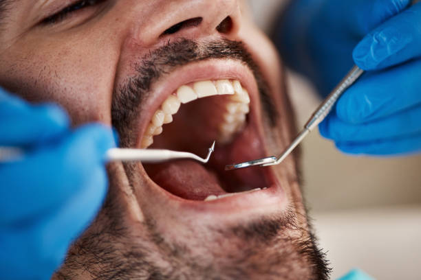 Best Emergency Cosmetic Dentistry (e.g., broken veneers) in Central High, OK