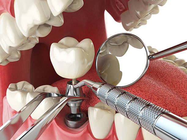 Best 24-Hour Emergency Dental Care in Central High, OK
